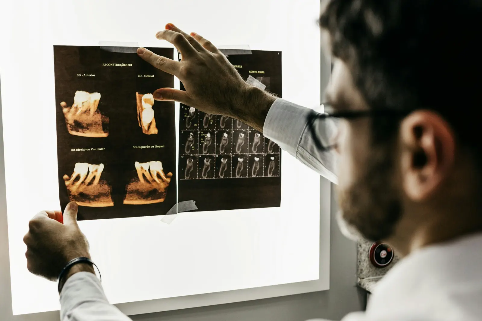 Odontólogo mostrando placas de una radiografía sobre un visor