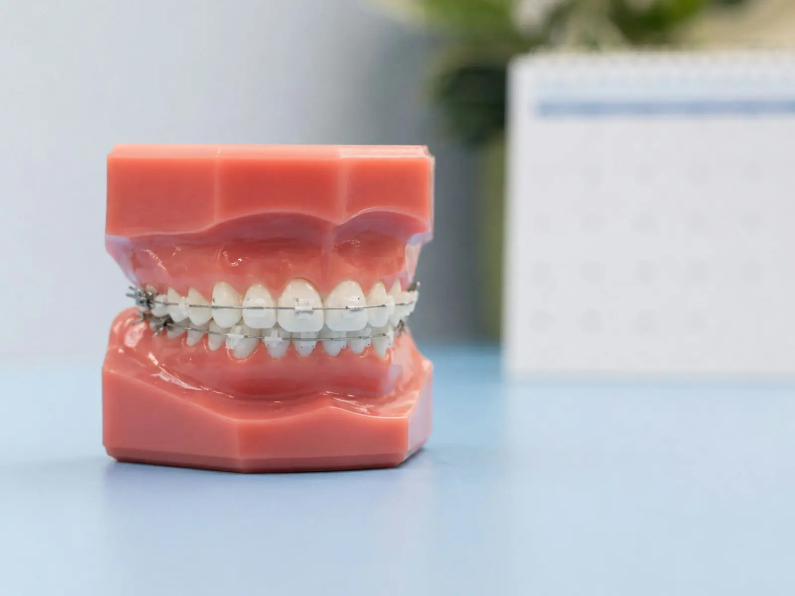 Modelo de dentadura con aparato, apoyado sobre una mesa